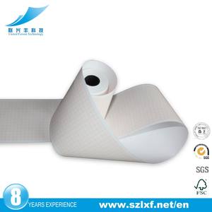 Kepadatan Tinggi Pencetakan Termal EKG Kertas Medis Grafik Kertas - Product Image 6