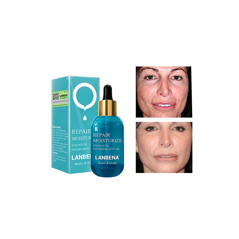 Lanbena Hyaluronzuur Essentie Olie (Nieuwe) Vitamine E Verstevigende Face-Lift Olie Hydraterende Repareren