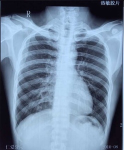 Green Sensitive X Ray Film Green Sensitive X Ray Film Suppliers And Manufacturers At Alibaba Com