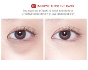 IMAGES Anti-rides Roll-on Acide Hyaluronique Anti-rides Crème pour les yeux pour éliminer les poches sous les yeux - Product Image 2