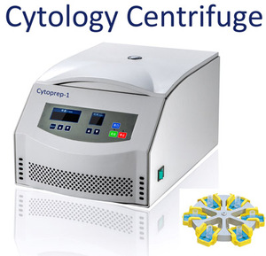 <span class=keywords><strong>cyto</strong></span> <span class=keywords><strong>centrifuge</strong></span>, medisch laboratorium <span class=keywords><strong>centrifuge</strong></span>, cel uitstrijkje <span class=keywords><strong>centrifuge</strong></span> cytoprep- 1 - Product Image 2