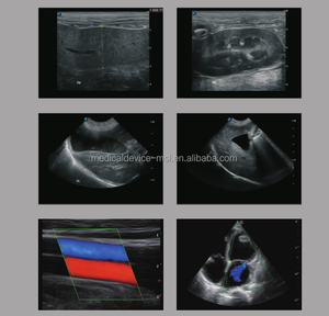 Harga Distribusi Tunggal <span class=keywords><strong>Sonoscape</strong></span> <span class=keywords><strong>S8</strong></span> <span class=keywords><strong>EXP</strong></span> Ultrasound di Seluruh Dunia - Product Image 5