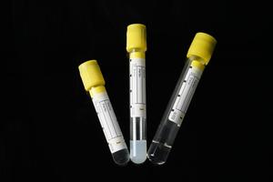 Высококачественная медицинская Стерильная микро вакуумная трубка для забора крови - Product Image 3