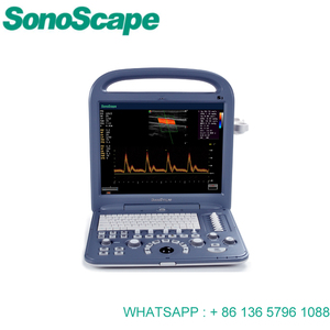 <span class=keywords><strong>Sonoscape</strong></span> <span class=keywords><strong>S2</strong></span> Portable <span class=keywords><strong>Sonoscape</strong></span> Usg Color Doppler Usg - Product Image 5