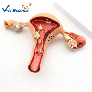 Medizinisches anatomisches Modell weibliche reproduktive patho logische Modelle medizinisches Bildungs modell - Product Image 2