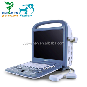 Alat USG Vaskular Portabel <span class=keywords><strong>Sonoscape</strong></span> X3 Doppler Warna Termurah dan Terpopuler - Product Image 5