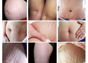 2023 Top <span class=keywords><strong>femme</strong></span> <span class=keywords><strong>enceinte</strong></span> corps suppression des vergetures crème pour le <span class=keywords><strong>visage</strong></span> - Product Image 6