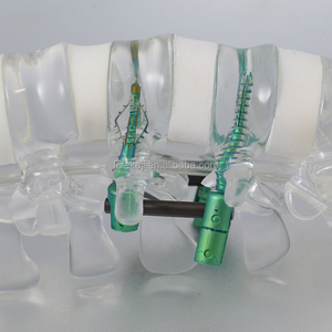 5.5 Titanyum <span class=keywords><strong>Spinal</strong></span> Vida Sistemi Ayarlanabilir Konnektör Ortopedik Omurga İmplantı - Product Image 3