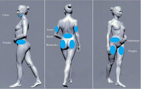 High Efficiency Relief Cryolipolysis Slimming Machine Non Invasive