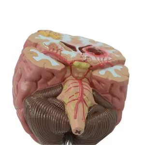 Brain Model Organs Human Body Anatomy Brain Model Of Stroke