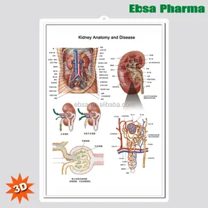 3D медицинские настенные таблицы анатомии человека/плакат-Анатомия почек и заболевания