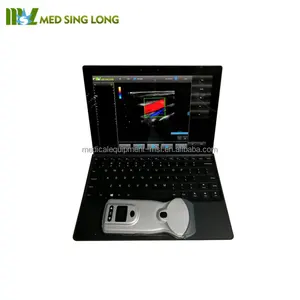 Kleur Doppler Goedkoper dan Ultrasound Toshiba