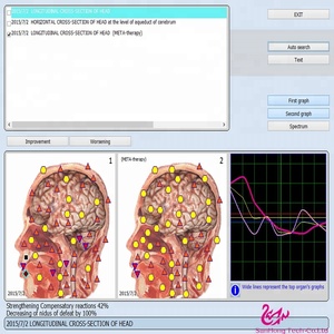 Sub-Salud 9d NLS analizador meridiano diagnóstico detector <span class=keywords><strong>tester</strong></span> con CE - Product Image 3