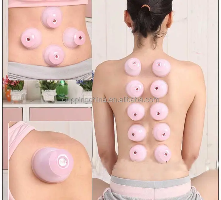 ChineseカッピングセットNatural Silicone Suction Cupping Set-12 Cupsカッピング療法