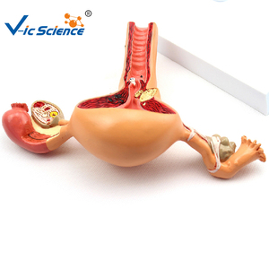 Medizinisches anatomisches Modell weibliche reproduktive patho logische Modelle medizinisches Bildungs modell - Product Image 6