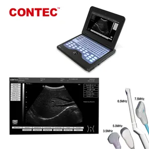 Contec CMS600P2 Draagbare Ultrasound Apparaat