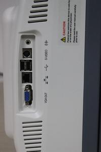 Giá Máy Siêu Âm Sonosape S2/Doppler Màu - Product Image 2