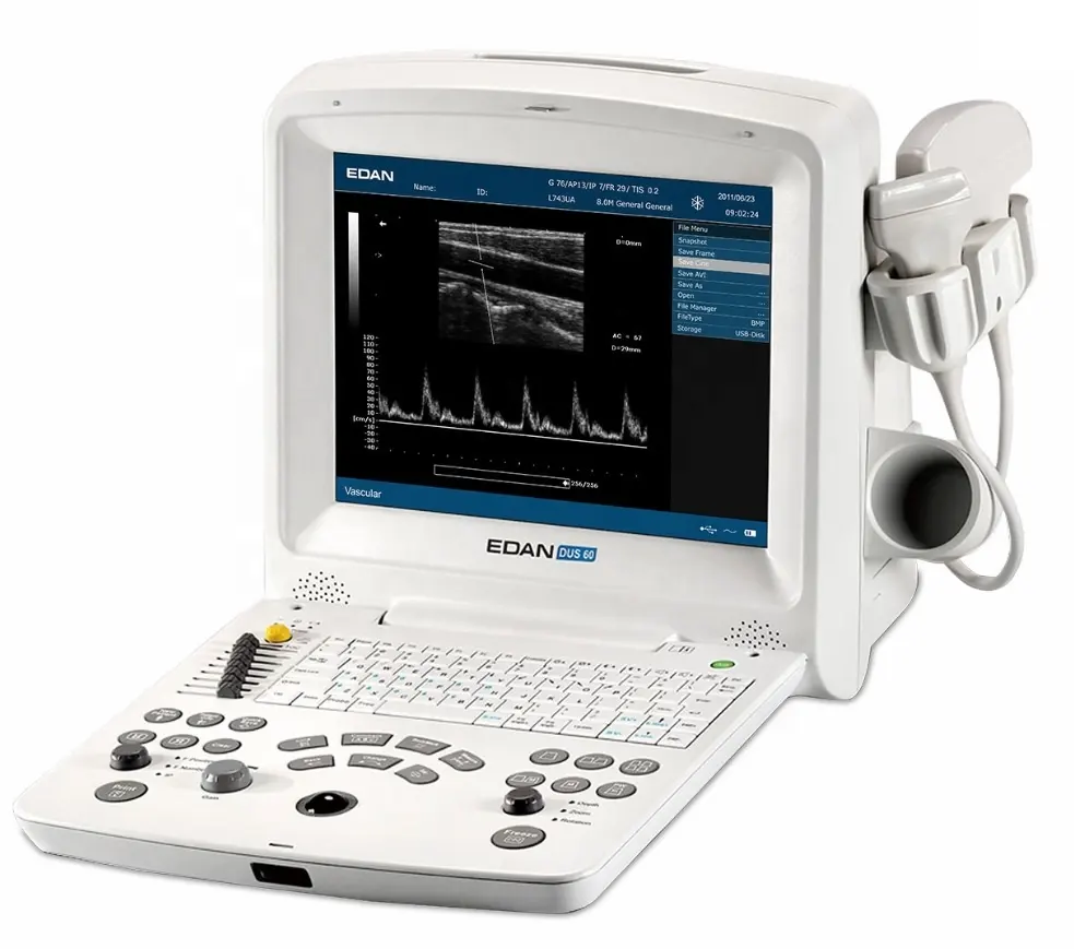 Edan DUS 60 Digital Ultrasound Máquina para Vet Portátil mais barato