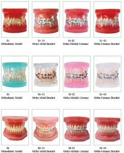 Modello dentale Ortodontico Con staffe in metallo - Product Image 5