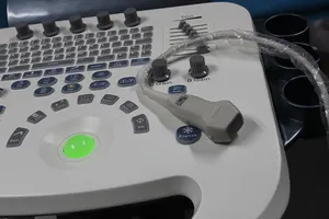 3D 4D Volledig Digitale Trolley Kleur Doppler Ultrasound Scanner