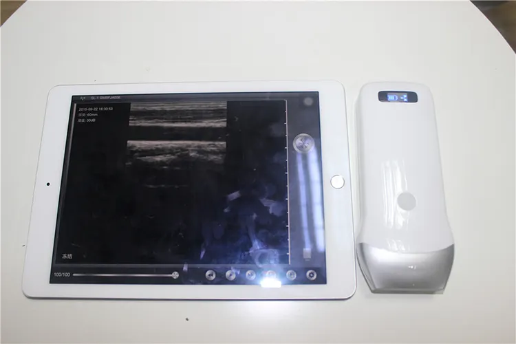 Portable ultrasound machine  wireless probe for phone/pad