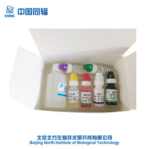 <span class=keywords><strong>Venta</strong></span> caliente <span class=keywords><strong>de</strong></span> alta calidad rápida <span class=keywords><strong>de</strong></span> un paso <span class=keywords><strong>de</strong></span> hbsag <span class=keywords><strong>de</strong></span> prueba <span class=keywords><strong>de</strong></span> antígeno <span class=keywords><strong>de</strong></span> superficie <span class=keywords><strong>de</strong></span> la hepatitis B kits <span class=keywords><strong>de</strong></span> prueba - Product Image 2