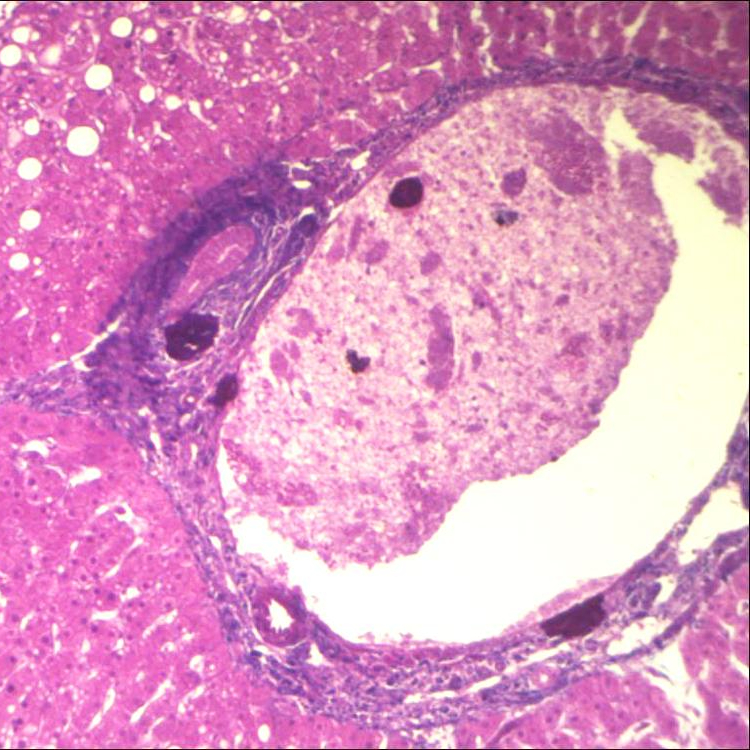 Фиксированный набор, высококачественные слайды из 50/100 шт., общая патология человека, приготовленные общая Патология