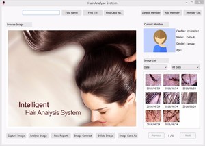 Hair Skin Iriscope Diagnosis Analyzer with Skin+<strong>Iris</strong>+Hair Analysis All in 1machine - Product Image 4