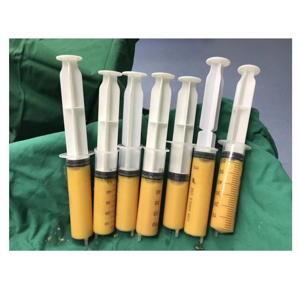 Оптовая продажа с завода, сепаратор центрифуги для жира