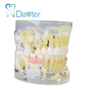 Modèle de dentisterie mixte, pour lumineux de dents manquantes, tétines primaire 1ère et 2ème génération, avec flipper, offre spéciale - Product Image 3