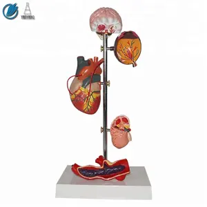 Medical Science Subject Human Hypertension Set Model