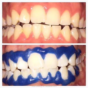 Escritorio blanqueadora de dientes para centro de belleza para blanquear los dientes luz led/blanqueamiento máquina
