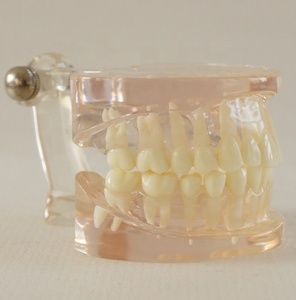 Dentale denti Trasparente modello <span class=keywords><strong>Standard</strong></span> - Product Image 3