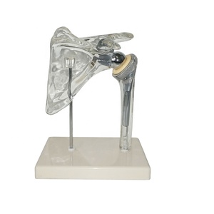 Medische Schouder <span class=keywords><strong>Implant</strong></span> Demonstratie <span class=keywords><strong>Model</strong></span> Voor Vervanging Chirurgie