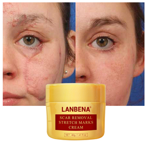 LANBENA stretch mark acné cicatriz eliminación crema pockmark de reparación - Product Image 1