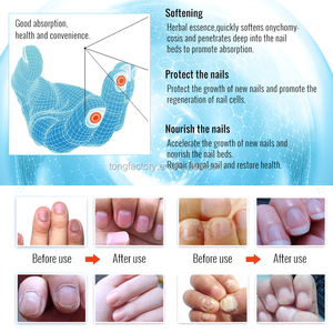 Sérum de réparation pour <span class=keywords><strong>ongles</strong></span>, ombré dame, art de manucure, lutte contre les champignons, sérum pour Salon de manucure, 10ml - Product Image 3