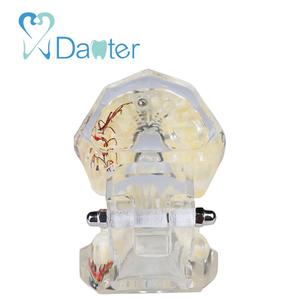 A200-2 All in one Dental Implant Model met Zenuw en Verwisselbare Tanden kroon bruggen - Product Image 4