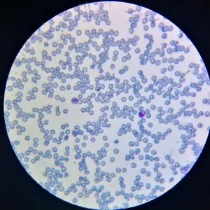 Microscópio preparado deslize de hematologia de alta qualidade preparados escorregadias de sangue smear