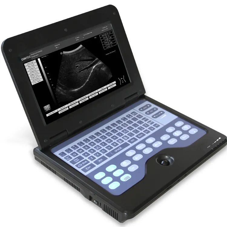 CONTEC — appareil à ultrasons portable, machine à ultrasons, bms600p2