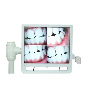 CE approved 17&quot; screen dental intraoral camera