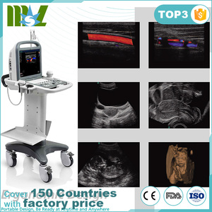 Máy Quét Siêu Âm Cầm Tay Soosape/Hệ Thống Siêu Âm Thú Y Tiện Dụng Giá Rẻ Ở Trung Quốc - Product Image 2