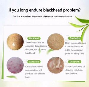 Oem nhãn hiệu riêng Bioaqua tre Đen Than mụn đầu đen Remover sâu lỗ chân lông làm sạch mặt nạ - Product Image 5