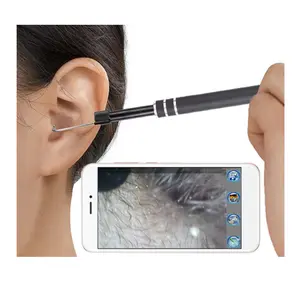 인기있는 저렴한 귀 비주얼 검사 카메라 3in1 USB otoscope 카메라 귀 코 목