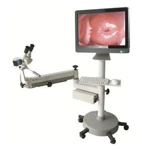 Горячая Распродажа 2022, CE зарегистрированный оптический микроскоп для женщин, система обследования влагалища для гинекологических испытаний