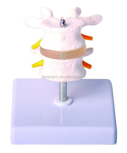 Vértebras lumbares con <span class=keywords><strong>hernia</strong></span> y <span class=keywords><strong>disco</strong></span> intervertebral sobresaliente Producto <span class=keywords><strong>de</strong></span> ciencia médica - Product Image 5
