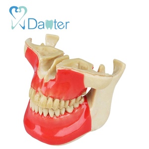 Hoge Kwaliteit Ortho Implantaat Praktijk Model Hars Materiaal - Product Image 1