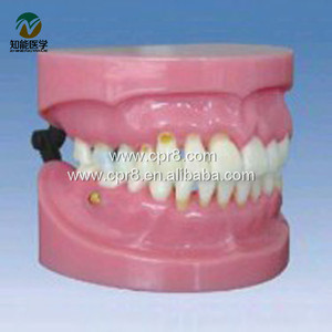 Modello Didattico L1022 per la Dimostrazione dei <span class=keywords><strong>Sintomi</strong></span> Clinici Dentali Complessivi delle <span class=keywords><strong>Malattie</strong></span> Parodontali, Prodotto a Shanghai - Product Image 2