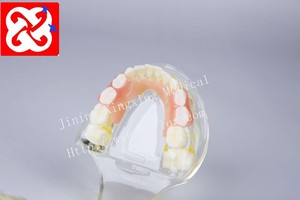 Mezcla de dentición modelo dental con los dientes permanentes y desdentado dientes de bebé y de retención - Product Image 4