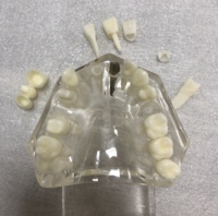 A2001 transparente implante dental modelo Restauración y patologías Dental estudio paciente Modelo de Educación
