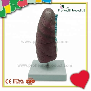 Modèle de poumon malade du système respiratoire en pathologie - Product Image 3